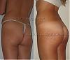 ceca`sbuttock1,5half.jpg