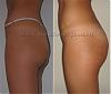 ceca`sbuttock1,5profile.jpg