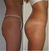 ceca`sbuttock1,5secondprofile.jpg