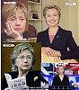 Hilary-clinton-plastic-surgery-before-after-pictures2.jpg