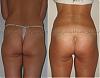 ceca`sbuttock1,5.jpg