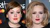 adele-cosmetic-surgery.jpg