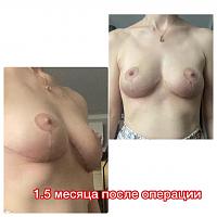     
: 199ece22.jpg
: 317
:	30,9 
ID:	410045