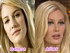 celeb-surgery05.jpg