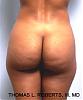 ideal_buttocks_aa2.jpg