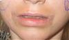 lips1.JPG