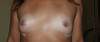 breasts.jpg